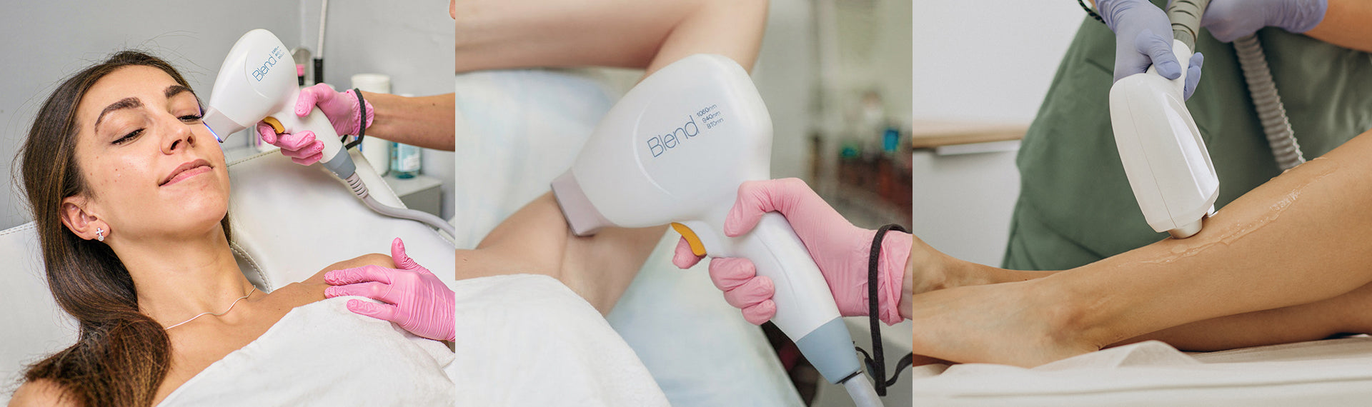 Laser Hair Removal Treatment Areas: A Complete Guide