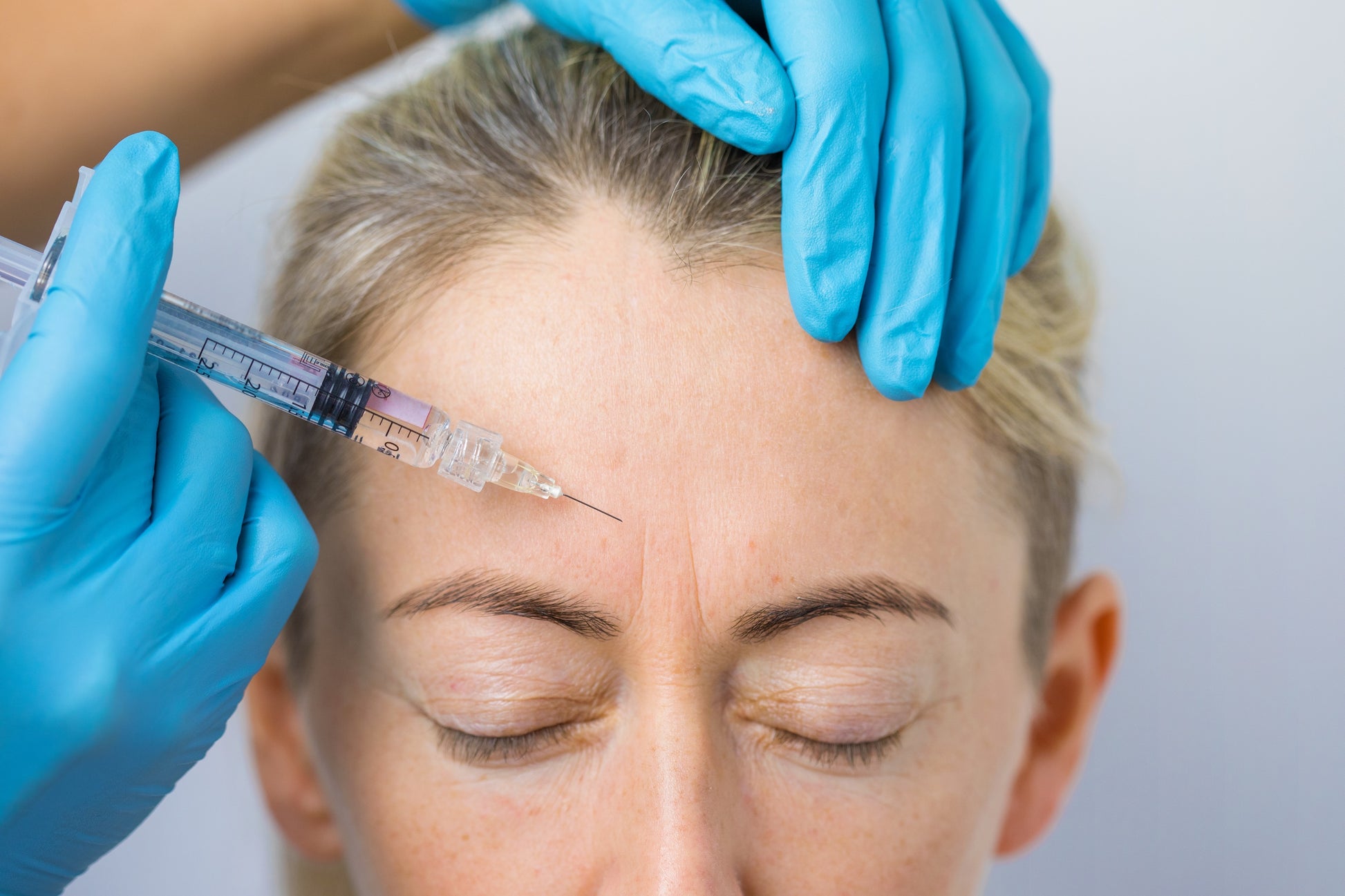 Girl receiving a facial injection with a syringe.