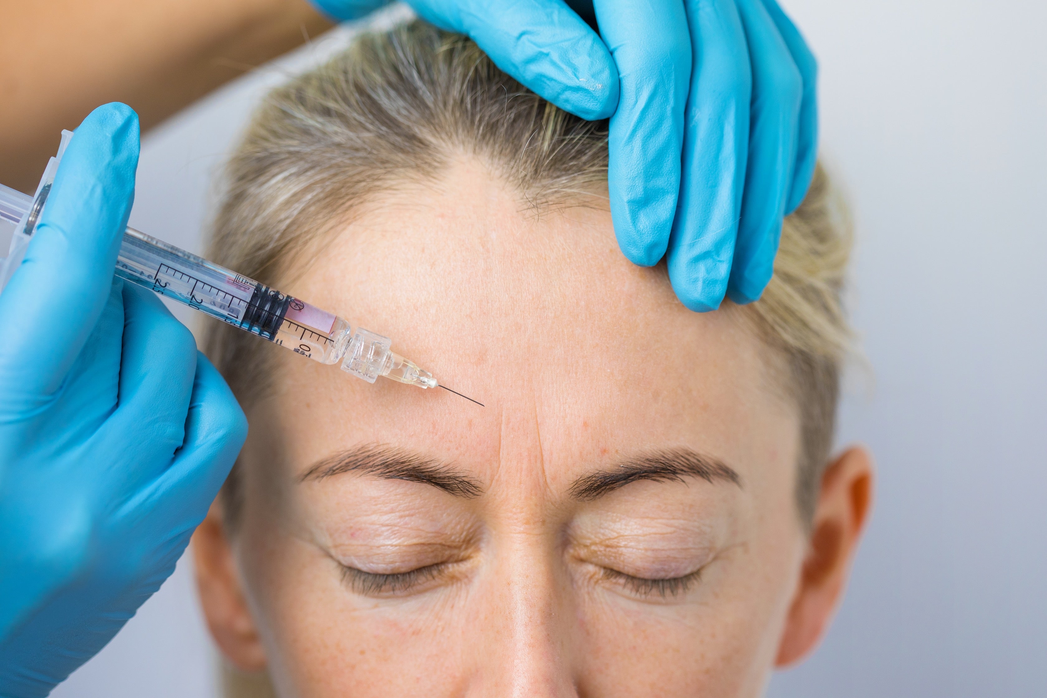 Girl receiving a facial injection with a syringe.