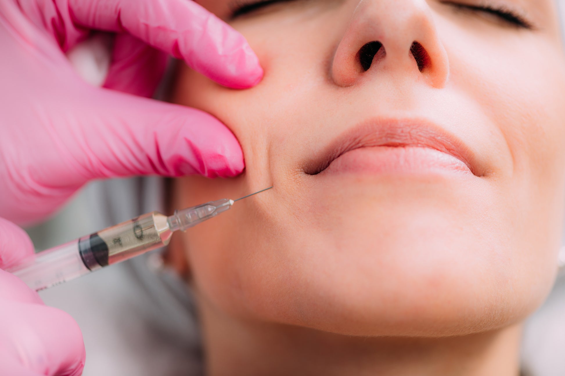 Person receiving a facial injection with a syringe held by gloved hands.