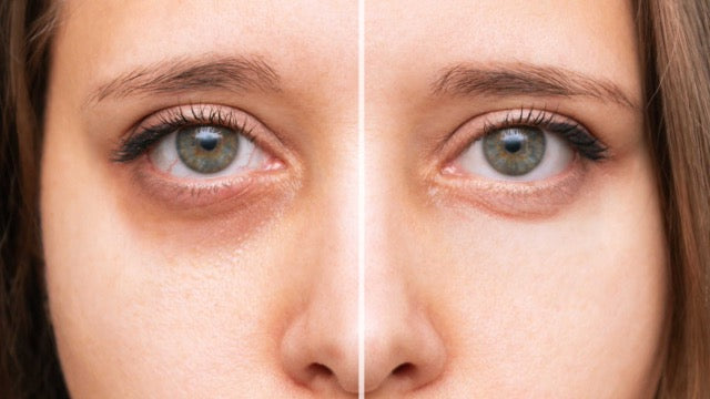 Close-up of a woman's face with a before and after comparison on her eyes.