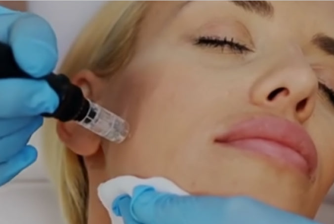 Person receiving a skin treatment on face