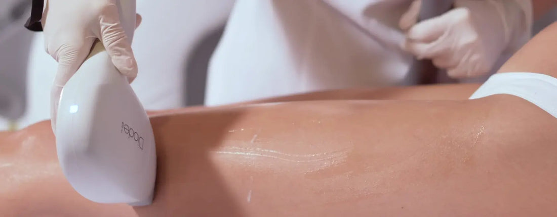 Person receiving laser hair removal treatment on their leg with a professional device.